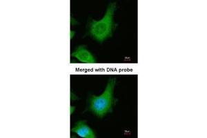 ICC/IF Image Immunofluorescence analysis of paraformaldehyde-fixed HeLa, using Calcium Sensing Receptor, antibody at 1:200 dilution. (CASR antibody)