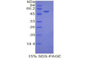 SDS-PAGE (SDS) image for Ephrin A4 (EFNA4) (AA 1-206) protein (His tag,GST tag) (ABIN2122781)