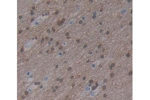 Used in DAB staining on fromalin fixed paraffin- embedded brain tissue