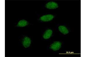 Immunofluorescence of purified MaxPab antibody to SNAI1 on HeLa cell. (SNAIL antibody  (AA 1-264))