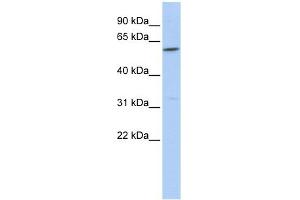 CEACAM16 antibody used at 1 ug/ml to detect target protein. (CEACAM16 antibody  (Middle Region))