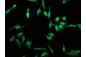 Immunofluorescence staining of Hela cells with ABIN7173813 at 1:330, counter-stained with DAPI. (FASL antibody  (AA 103-281))