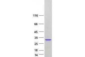 Validation with Western Blot (SAR1A Protein (Transcript Variant 1) (Myc-DYKDDDDK Tag))