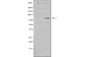 Western blot analysis of extracts from K562 cells, using MLH1 antibody.