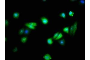 Immunofluorescence staining of HepG2 cells with ABIN7152575 at 1:133, counter-stained with DAPI. (FAIM antibody  (AA 1-179))