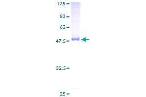 serine Dehydratase Protein (SDS) (AA 1-218) (GST tag)