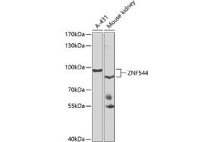 Western blot analysis of extracts of various cell lines, using ZNF544 antibody (ABIN6133073, ABIN6150511, ABIN6150513 and ABIN6223223) at 1:1000 dilution. (ZNF544 antibody  (AA 1-230))