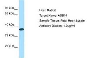 Image no. 1 for anti-Ankyrin Repeat and SOCS Box Containing 14 (ASB14) (AA 45-94) antibody (ABIN6750157) (ASB14 antibody  (AA 45-94))