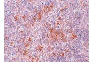Immunohistochemical staining of mouse kidney tissue with 2. (Angiotensin II Type-1 Receptor antibody  (Internal Region))
