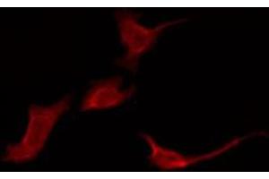 ABIN6276090 staining Hela by IF/ICC. (OR52E1 antibody  (Internal Region))