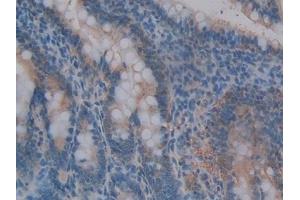 Detection of MMP3 in Rat Intestine Tissue using Polyclonal Antibody to Matrix Metalloproteinase 3 (MMP3) (MMP3 antibody  (AA 98-475))