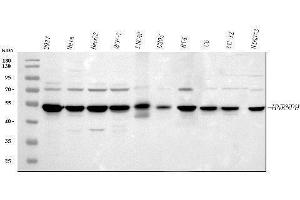 Western blot analysis of HnRNP H/HNRNPH1 using anti-HnRNP H/HNRNPH1 antibody (ABIN4886623).
