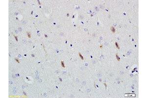 Immunohistochemistry (Paraffin-embedded Sections) (IHC (p)) image for anti-Neuroligin 1 (NLGN1) (AA 701-800) antibody (ABIN705311)
