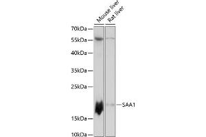 Western blot analysis of extracts of various cell lines, using S antibody (ABIN7270255) at 1:3000 dilution. (SAA1 antibody  (AA 1-100))