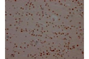 IHC image of ABIN7127371 diluted at 1:100 and staining in paraffin-embedded human brain tissue performed on a Leica BondTM system. (Recombinant BRD4 antibody)