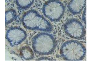 Figure. (ITGAD antibody  (AA 879-1099))