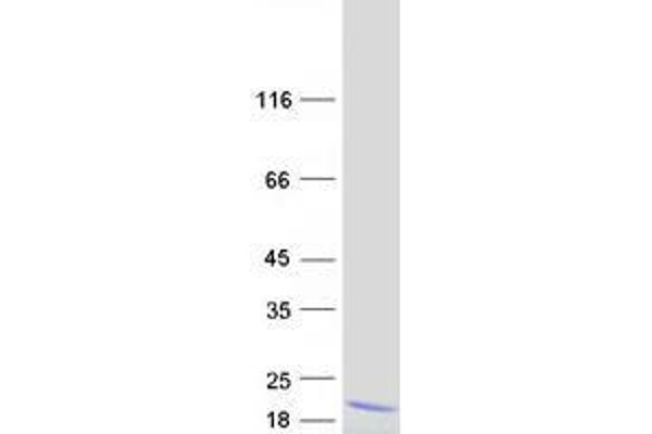 CTD Nuclear Envelope Phosphatase 1 Regulatory Subunit 1 (CNEP1R1) protein (Myc-DYKDDDDK Tag)