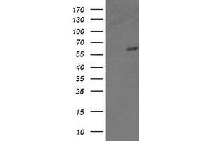 HEK293T cells were transfected with the pCMV6-ENTRY control (Left lane) or pCMV6-ENTRY GTF2F1 (Right lane) cDNA for 48 hrs and lysed. (GTF2F1 antibody)