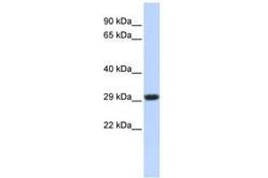 Image no. 1 for anti-Succinate Dehydrogenase Complex, Subunit B, Iron Sulfur (Ip) (SDHB) (C-Term) antibody (ABIN6741010) (SDHB antibody  (C-Term))