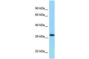 Image no. 1 for anti-Rh Blood Group, D Antigen (RHD) (AA 165-214) antibody (ABIN6748103) (RHD antibody  (AA 165-214))