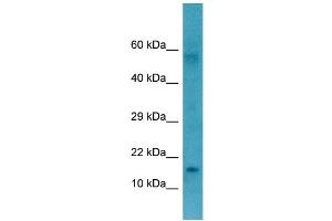 WB Suggested Anti-CTAG1B Antibody Titration: 1. (CTAG1B antibody  (Middle Region))