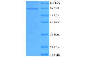 SDS-PAGE (SDS) image for serine/threonine Kinase 11 (STK11) (AA 1-429), (partial) protein (His-SUMO Tag) (ABIN5711343)