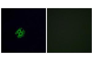 Immunofluorescence analysis of A549 cells, using OR2G2 antibody.