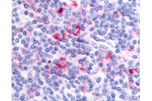 Anti-GPRC5D antibody IHC of human tonsil. (GPRC5D antibody  (Cytoplasmic Domain))