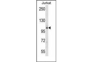 Western blot analysis of MAP4K2 Antibody (Center) in Jurkat cell line lysates (35ug/lane). (MAP4K2 antibody  (Middle Region))