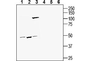 Western blot analysis of human SH-SY5Y neuroblastoma cell line lysate (lanes 1 and 4), human  monocytic leukemia cell line lysate (lanes 2 and 5) and human LNCaP prostate adenocarcinoma cell line lysate (lanes 3 and 6):1-3. (TMEM175 antibody  (AA 278-291))