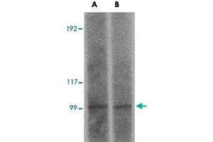 Western blot analysis of FRMPD2 in rat kidney tissue lysate with FRMPD2 polyclonal antibody  at (A) 1 and (B) 2 ug/mL .