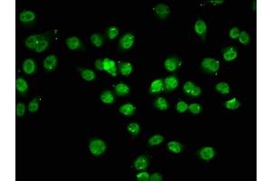 Immunofluorescence staining of Hela cells (treated with 30mM sodium butyrate for 4h) with ABIN7139194 at 1:7. (HIST1H1C antibody  (acLys74))