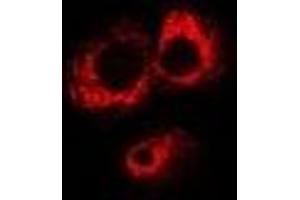 Immunofluorescent analysis of ABO staining in MCF7 cells. (ABO antibody)