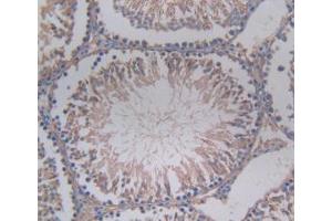 DAB staining on IHC-P; Samples: Rat Testis Tissue. (SERPINA6 antibody  (AA 173-344))