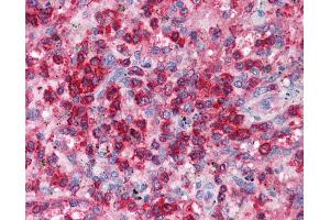 Human Heart; EAP30 antibody - N-terminal region in Human Heart cells using Immunohistochemistry (SNF8 antibody  (N-Term))