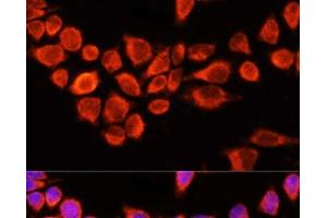 Immunofluorescence analysis of 293T cells using AADAC Polyclonal Antibody at dilution of 1:100 (40x lens). (AADAC antibody)