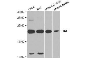 Western blot analysis of extracts of various cell lines, using TNFα antibody. (TNF alpha antibody  (AA 1-233))