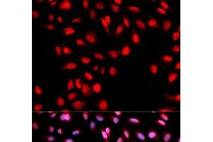 Immunofluorescence analysis of U2OS cells using Phospho-MET(Y1003) Polyclonal Antibody (c-MET antibody  (pTyr1003))