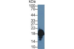Detection of CPLX1 in Rat Cerebrum lysate using Polyclonal Antibody to Complexin 1 (CPLX1) (Complexin 1 antibody  (AA 1-134))
