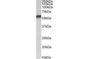 Western Blotting (WB) image for anti-Nuclear Receptor Subfamily 5, Group A, Member 2 (NR5A2) (Internal Region) antibody (ABIN1781851)
