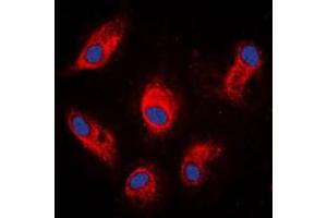 Immunofluorescent analysis of Involucrin staining in MCF7 cells. (Involucrin antibody  (C-Term))