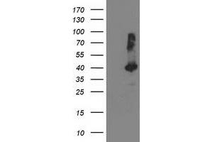 HEK293T cells were transfected with the pCMV6-ENTRY control (Left lane) or pCMV6-ENTRY TBC1D21 (Right lane) cDNA for 48 hrs and lysed. (TBC1D21 antibody)