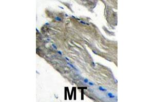 Formalin-fixed and paraffin-embedded human muscle tissue reacted with PIK3CG polyclonal antibody  , which was peroxidase-conjugated to the secondary antibody, followed by DAB staining. (PIK3 gamma antibody  (C-Term))
