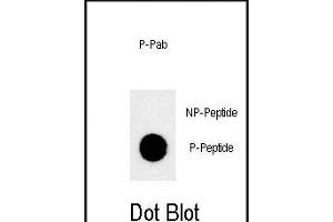 Dot blot analysis of anti-Phospho-JMJD1B-p Phospho-specific Pab (ABIN650878 and ABIN2839821) on nitrocellulose membrane.