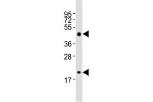 Western blot testing of Shh antibody at 1:2000 dilution + mouse stomach lysate (Sonic Hedgehog antibody  (N-Term))