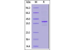 Human CD20 Full Length, His Tag (HEK293) (SPR verified) on  under reducing (R) condition. (CD20 Protein (AA 1-297) (His tag))