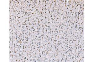 IHC analysis of SND1 using anti-SND1 antibody (ABIN7600525).