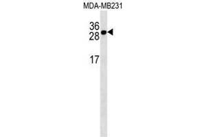 TNFRSF17 Antibody (Center) western blot analysis in MDA-MB231 cell line lysates (35 µg/lane).