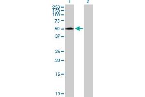 Western Blot analysis of RCN2 expression in transfected 293T cell line by RCN2 MaxPab polyclonal antibody. (RCN2 antibody  (AA 1-317))