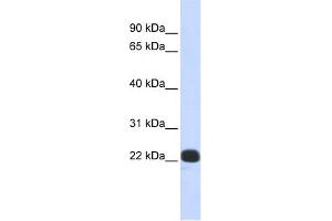 WB Suggested Anti-RCVRN Antibody Titration:  0.